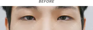 Before