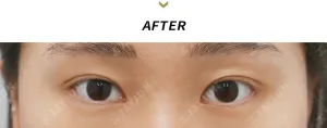 After