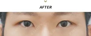 After