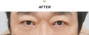 After