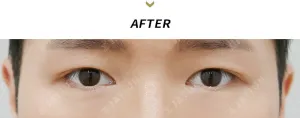 After