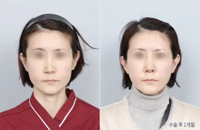 Before & After