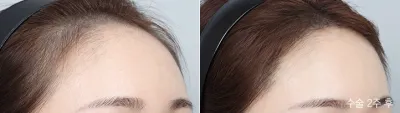 Before & After