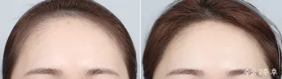 Before & After