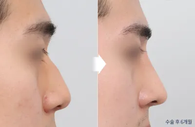 Before & After