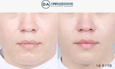 Before & After