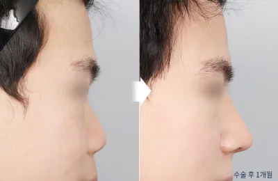 Before & After