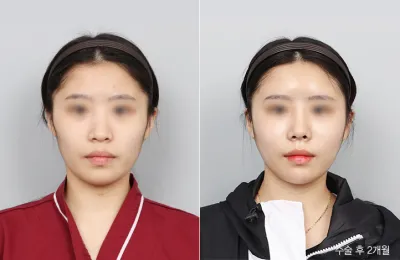 Before & After