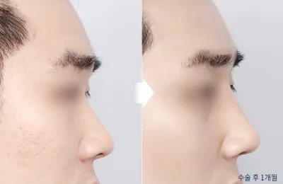 Before & After