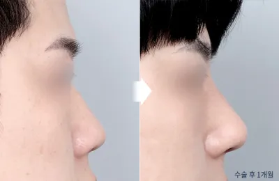 Before & After