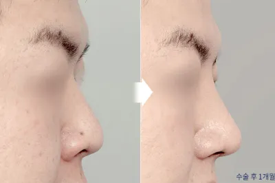 Before & After