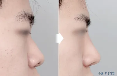 Before & After