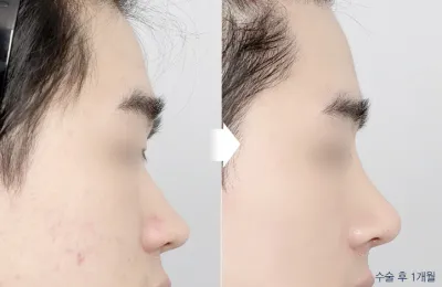 Before & After