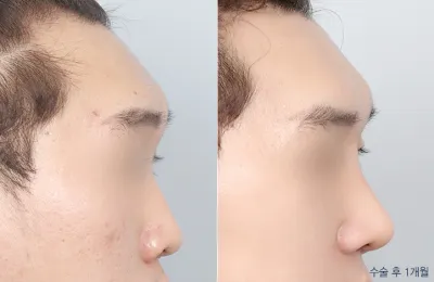 Before & After