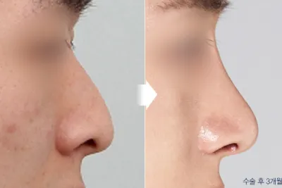 Before & After