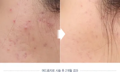 Before & After