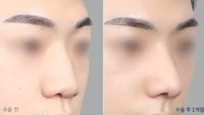 Before & After