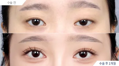 Before & After