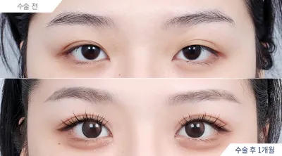 Before & After