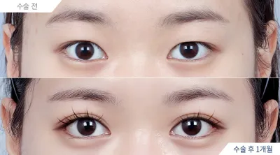 Before & After