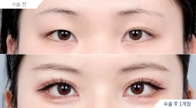 Before & After