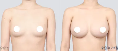 Before & After