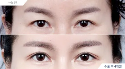 Before & After