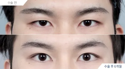 Before & After