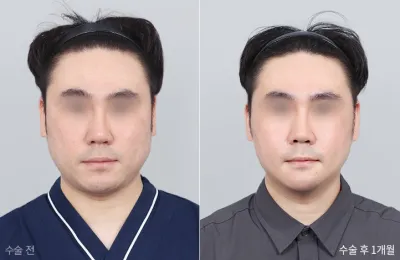 Before & After