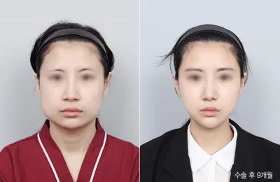 Before & After