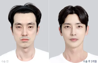Before & After