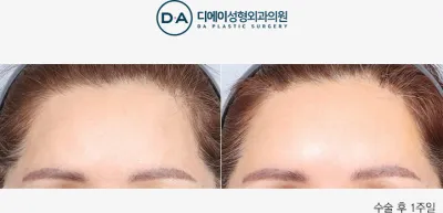 Before & After