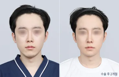 Before & After