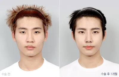 Before & After