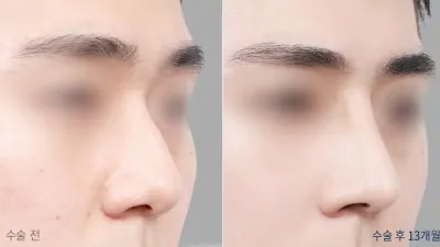 Before & After