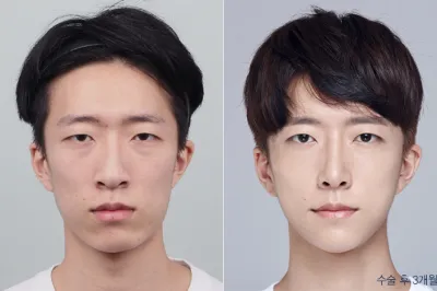 Before & After
