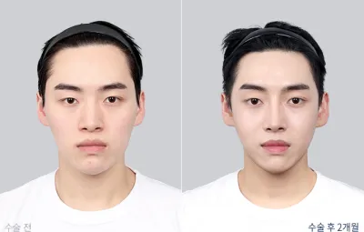 Before & After