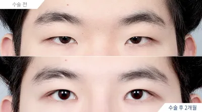 Before & After