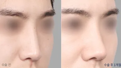 Before & After
