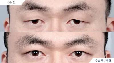 Before & After