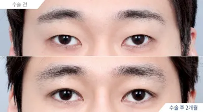 Before & After