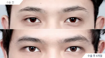 Before & After