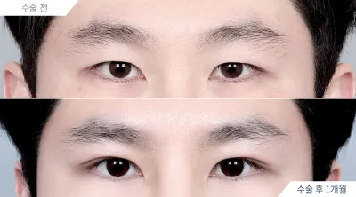 Before & After