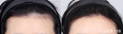 Before & After