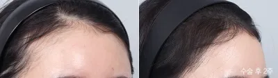Before & After