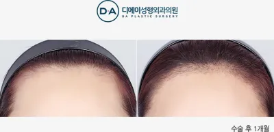 Before & After