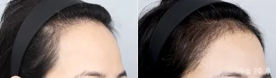 Before & After