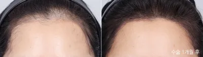 Before & After