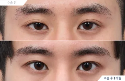 Before & After