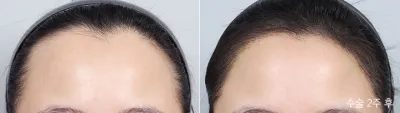 Before & After